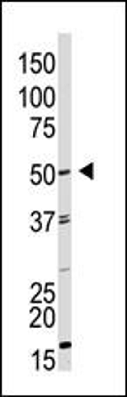 Antibody is used in Western blot to detect GDF9 in HL60 cell lysate.