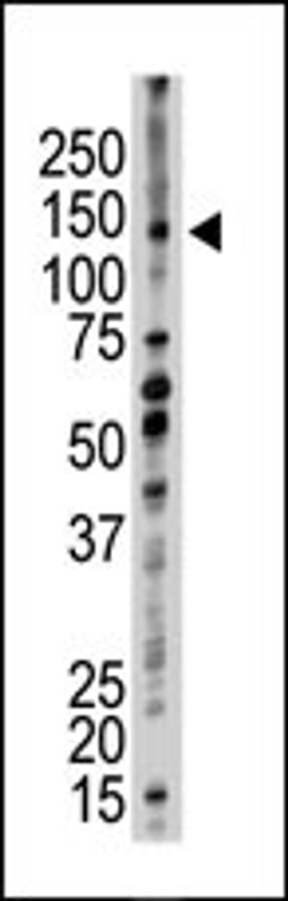 Antibody is used in Western blot to detect UBE4B in mouse kidney tissue lysate.