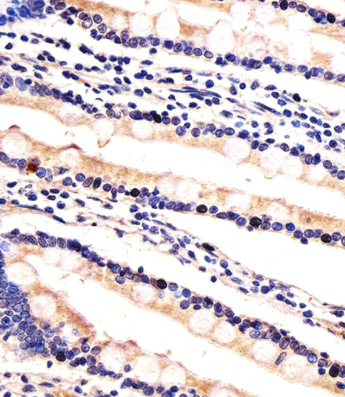 Immunohistochemical analysis of paraffin-embedded H. small intestine section using HIP2 Antibody . Antibody was diluted at 1:100 dilution. A undiluted biotinylated goat polyvalent antibody was used as the secondary, followed by DAB staining.