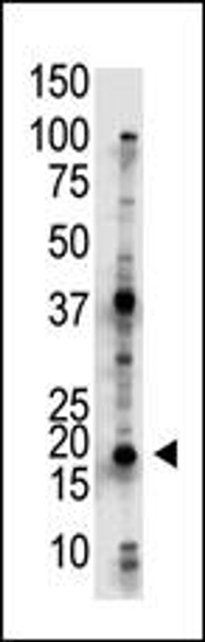 Antibody is used in Western blot to detect UBE2G2 in Jurkat cell lysate.