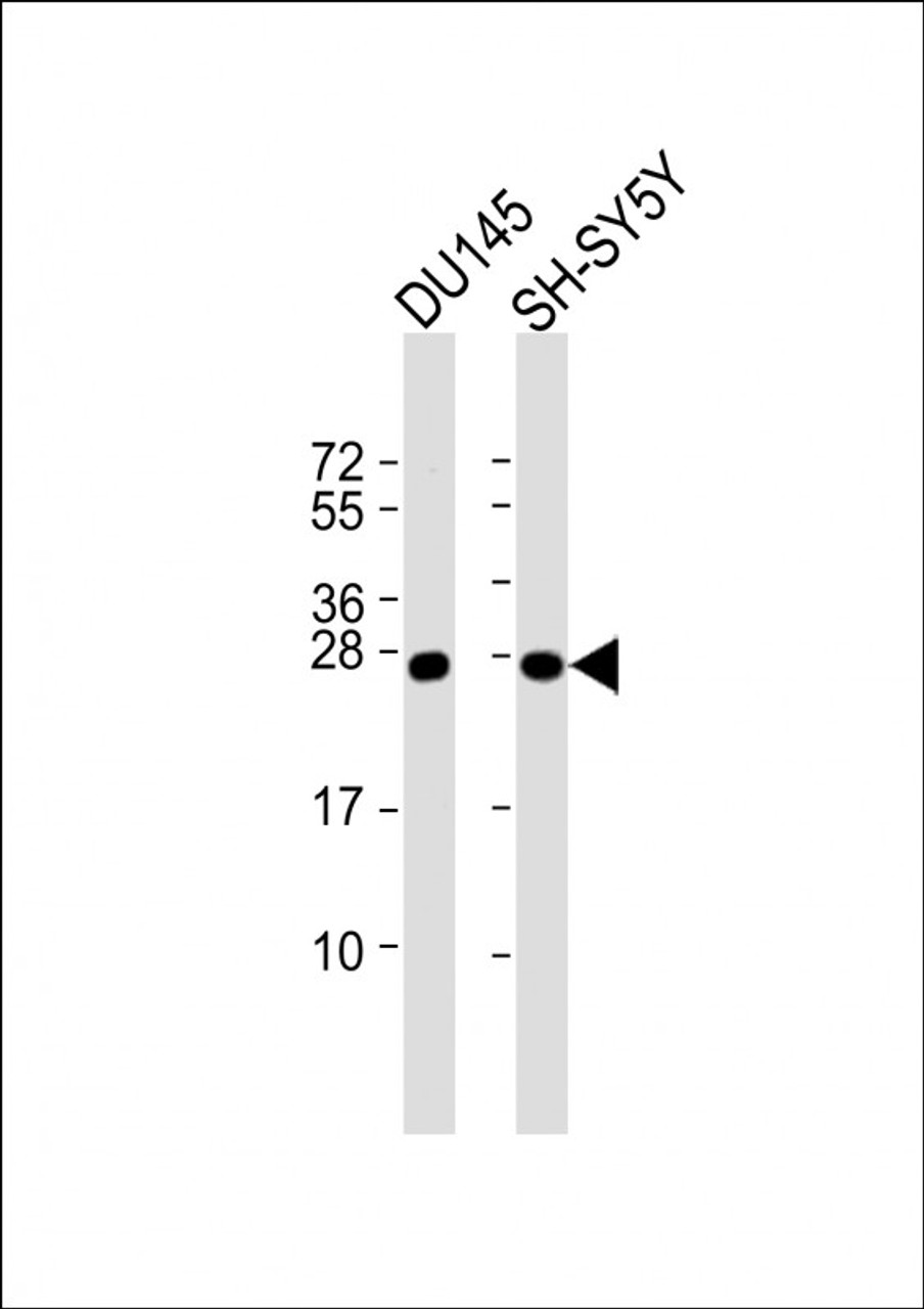 Western Blot at 1:1000 dilution Lane 1: DU145 whole cell lysate Lane 2: SH-SY5Y whole cell lysate Lysates/proteins at 20 ug per lane.