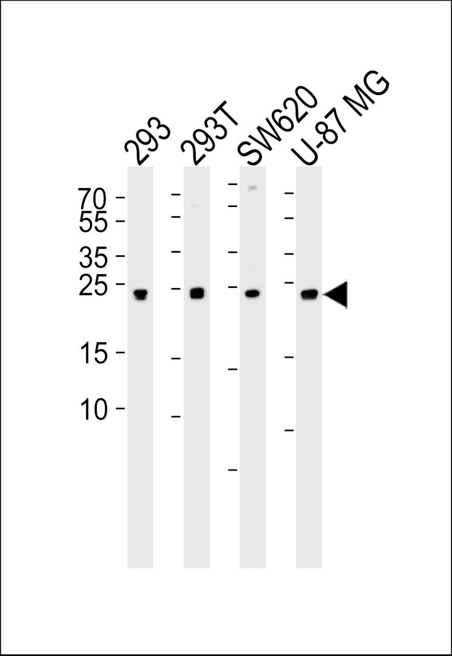 Western blot analysis of lysates from 293, 293T, SW620, U-87 MG cell line (from left to right) , using UCHL3 Antibody (C209) at 1:1000 at each lane.