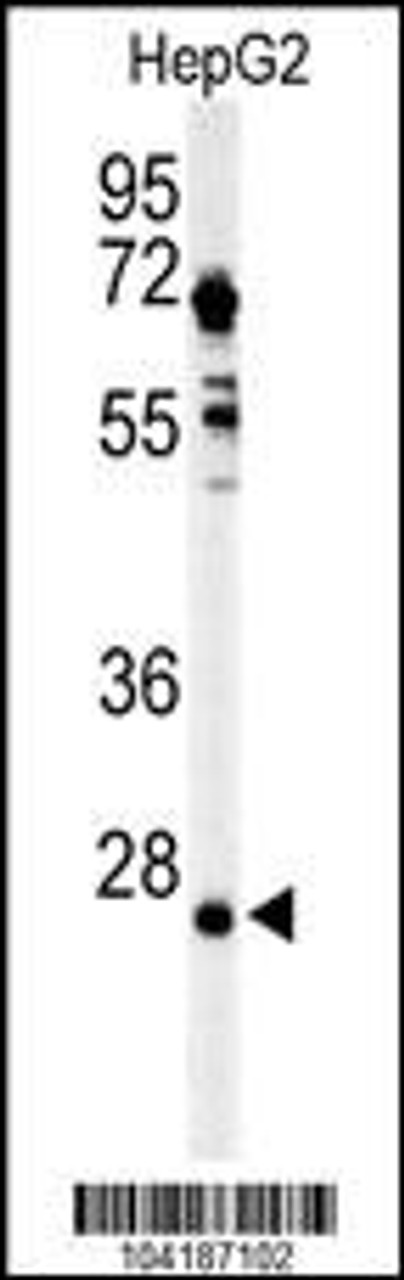 Western blot analysis of UCHL3 in HepG2 cell line lysates (35ug/lane)