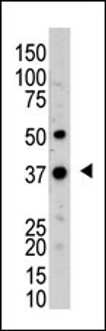 Antibody is used in Western blot to detect UCHL5 in mouse kidney tissue lysate.