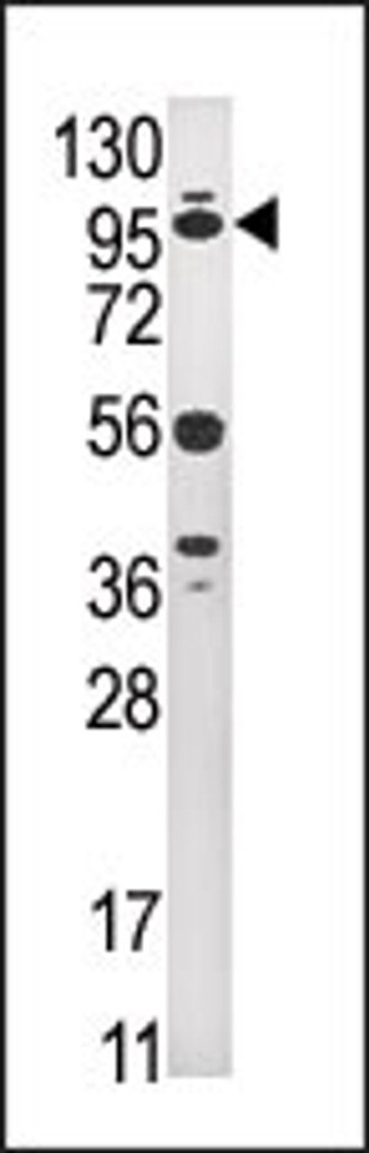 Western blot analysis of anti-USP1 Pab in HepG2 cell line lysate (35ug/lane) .