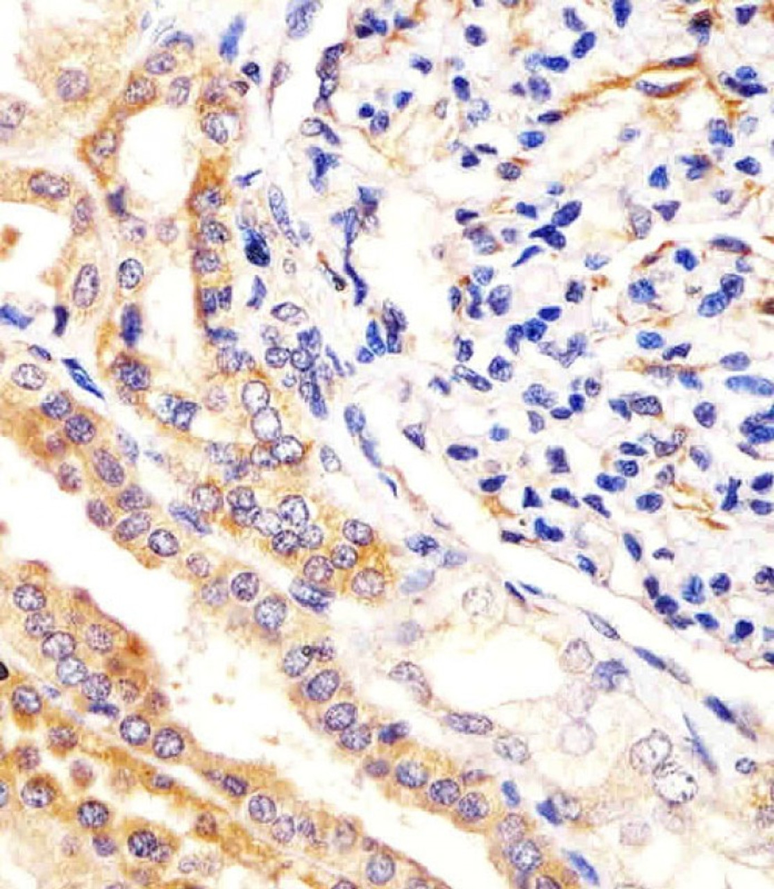 Antibody staining USP2 in human kidney tissue sections by Immunohistochemistry (IHC-P - paraformaldehyde-fixed, paraffin-embedded sections) .