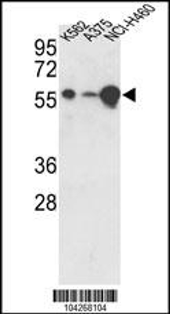Western blot analysis of hUSP3-Y505 in K562, A375, NCI-H460 cell line lysates (35ug/lane)
