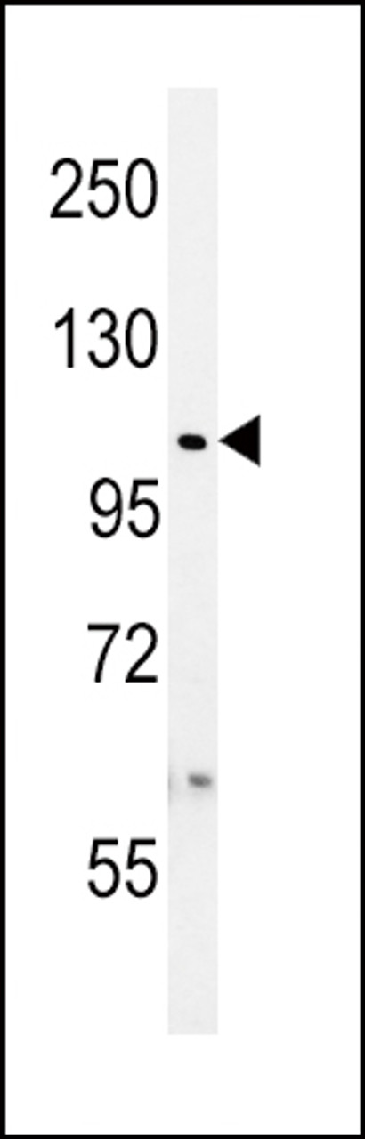 Western blot analysis in WiDr cell line lysates (35ug/lane) .This demonstrates the USP8 antibody detected the USP8 protein (arrow) .