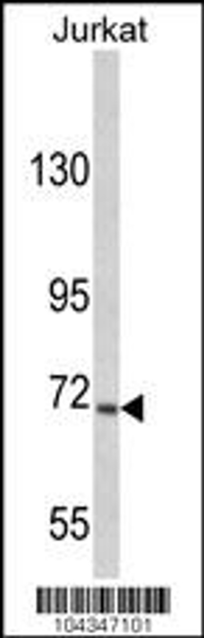 Western blot analysis of hUSP19-L1304 in Jurkat cell line lysates (35ug/lane)