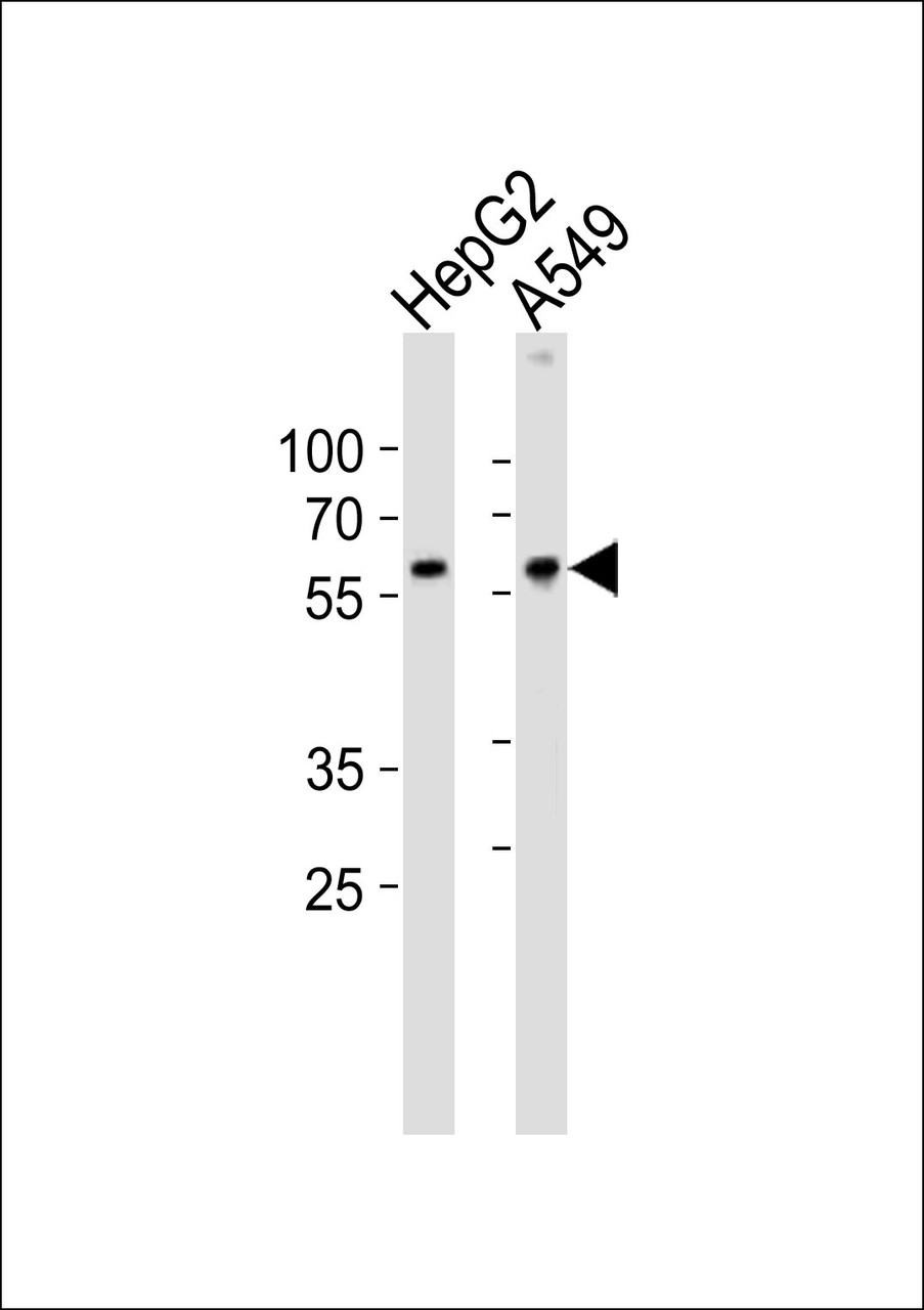 Western blot analysis of lysates from HepG2, A549 cell line (from left to right) , using USP22 Antibody at 1:1000 at each lane.