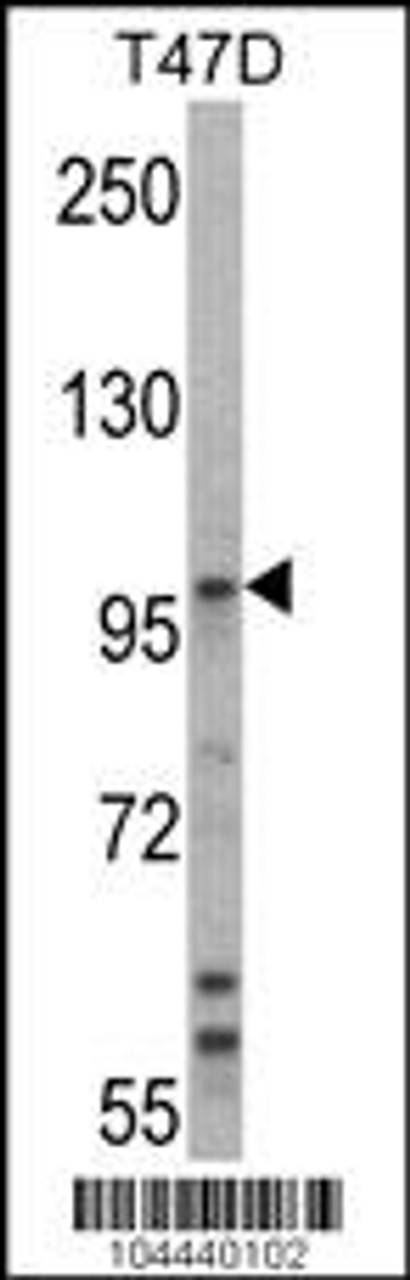 Western blot analysis of UBE3A Antibody in T47D cell line lysates (35ug/lane) .