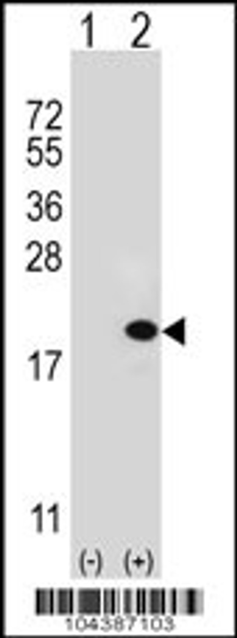Western blot analysis of UBE2V1 using rabbit polyclonal UBE2V1 Antibody (M151) using 293 cell lysates (2 ug/lane) either nontransfected (Lane 1) or transiently transfected (Lane 2) with the UBE2V1 gene.