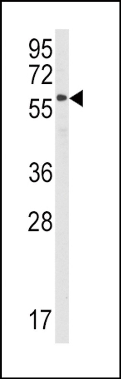 Western blot analysis of anti-STAM Antibody in Hela cell line lysates (35ug/lane)