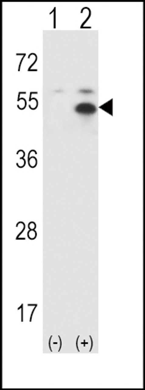 Western blot analysis of STAM using rabbit polyclonal STAM Antibody (P341) using 293 cell lysates (2 ug/lane) either nontransfected (Lane 1) or transiently transfected (Lane 2) with the STAM gene.