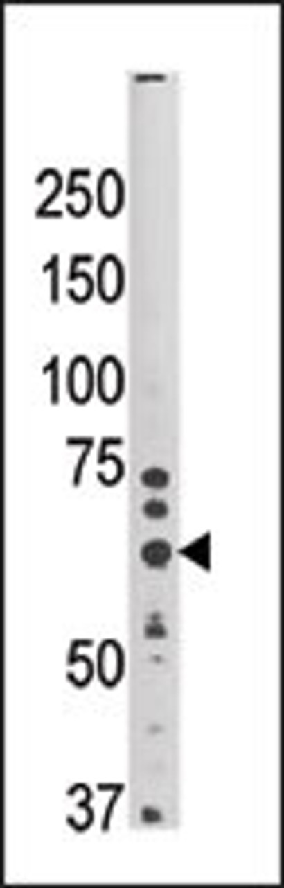 Western blot analysis of anti-HRD1 Pab in mouse brain tissue lysate (35ug/lane)