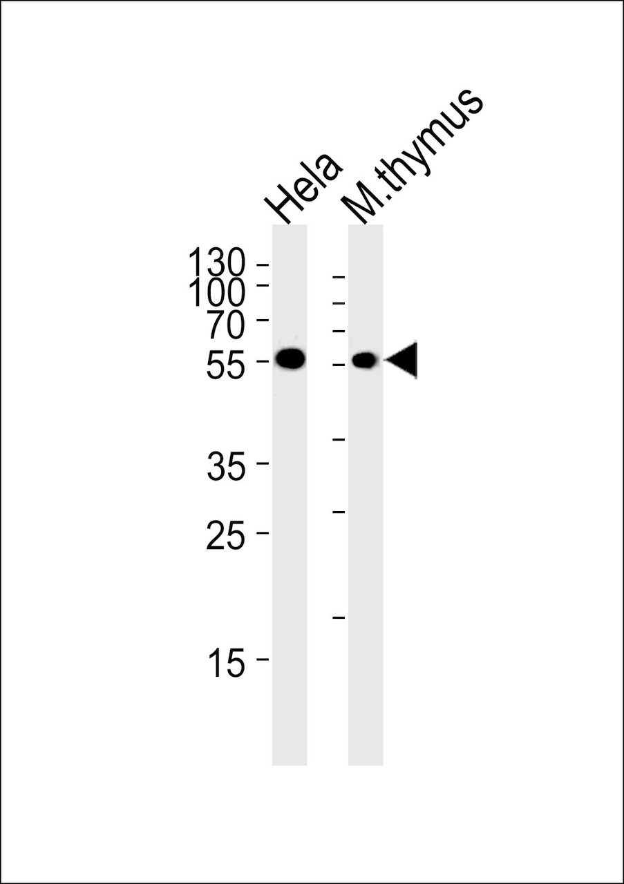 Western blot analysis in Hela cell line and mouse thymus tissue lysates (35ug/lane) .