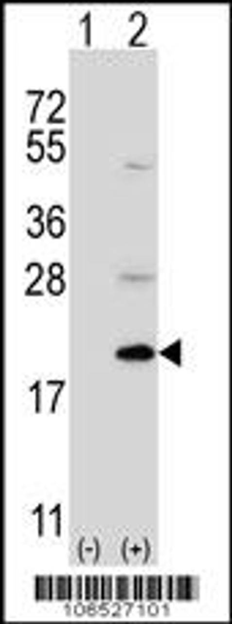 Western blot analysis of Ufc1 using rabbit polyclonal Ufc1 Antibody using 293 cell lysates (2 ug/lane) either nontransfected (Lane 1) or transiently transfected (Lane 2) with the Ufc1 gene.