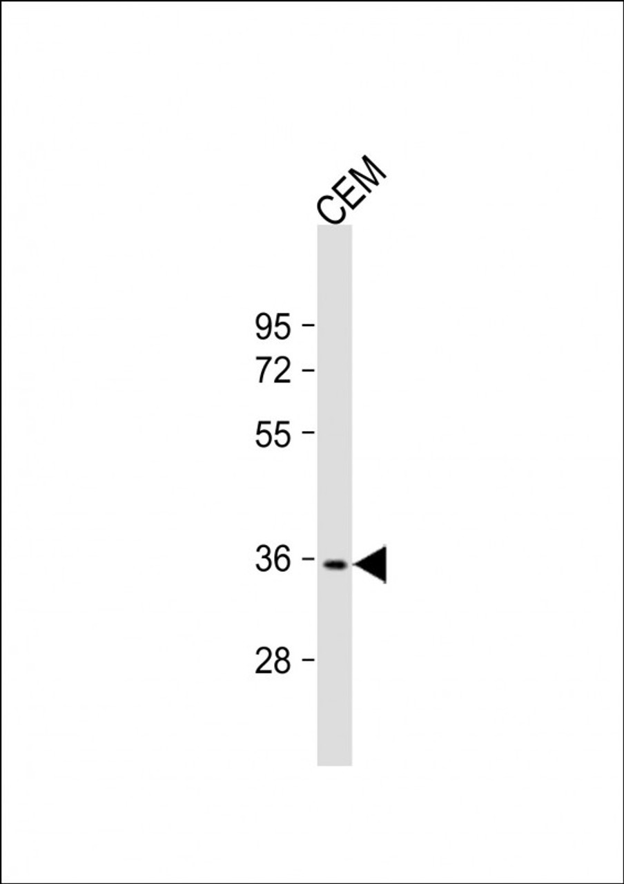 Western Blot at 1:2000 dilution + CEM whole cell lysate Lysates/proteins at 20 ug per lane.