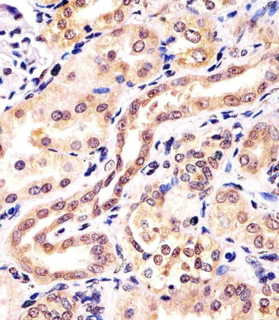 Antibody staining KCTD11 in human kidney tissue sections by Immunohistochemistry (IHC-P - paraformaldehyde-fixed, paraffin-embedded sections) .