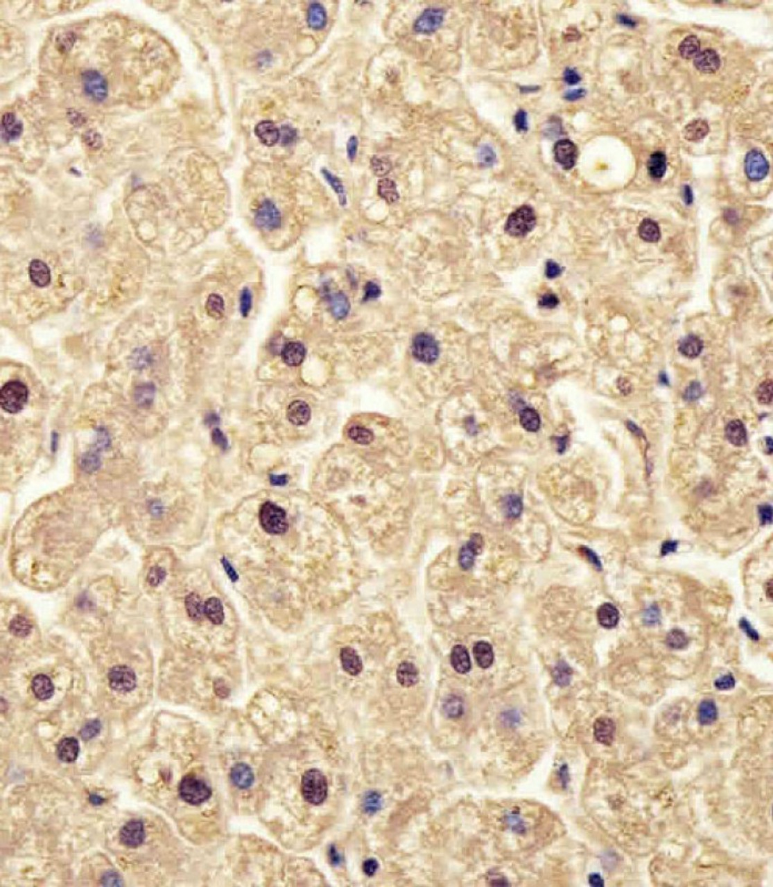 Antibody staining PGM1 in human liver tissue sections by Immunohistochemistry (IHC-P - paraformaldehyde-fixed, paraffin-embedded sections) .