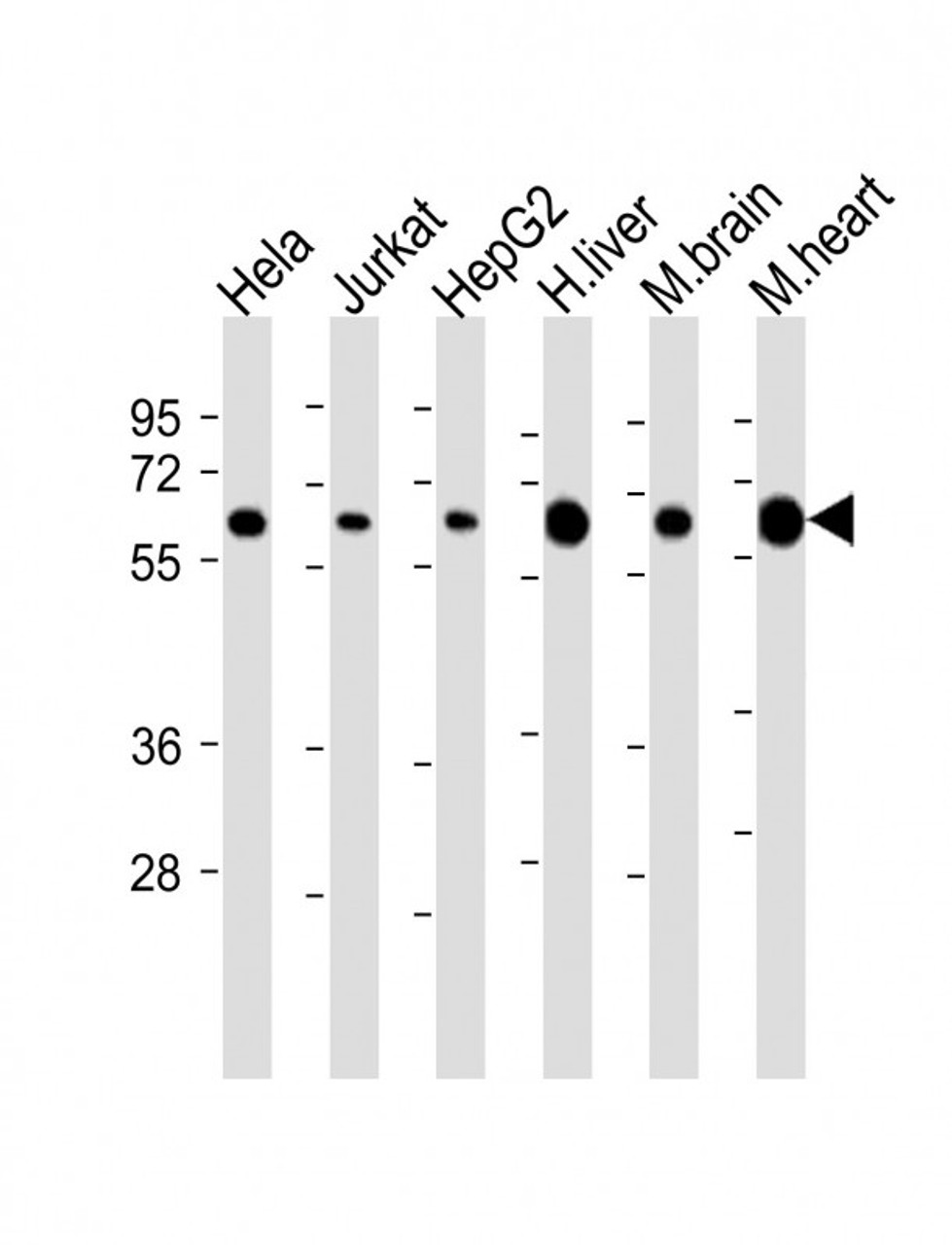 Western Blot at 1:2000 dilution Lane 1: Hela whole cell lysate Lane 2: Jurkat whole cell lysate Lane 3: HepG2 whole cell lysate Lane 4: human liver lysate Lane 5: mouse brain lysate Lane 6: mouse heart lysate Lysates/proteins at 20 ug per lane.