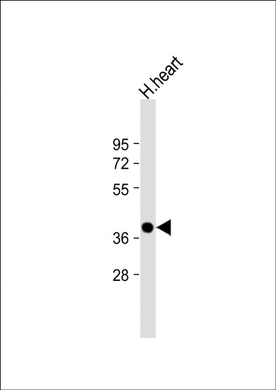 Western Blot at 1:2000 dilution + human heart lysate Lysates/proteins at 20 ug per lane.