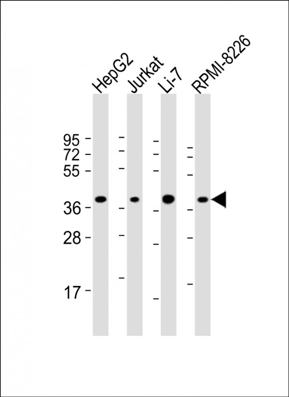 Western Blot at 1:2000 dilution Lane 1: HepG2 whole cell lysate Lane 2: Jurkat whole cell lysate Lane 3: Li-7 whole cell lysate Lane 4: RPMI-8226 whole cell lysate Lysates/proteins at 20 ug per lane.