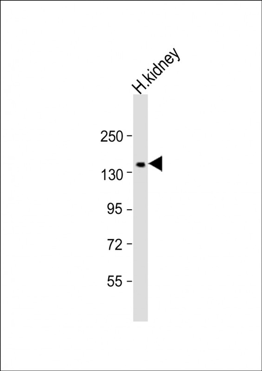 Western Blot at 1:1000 dilution + kidney lysate Lysates/proteins at 20 ug per lane.