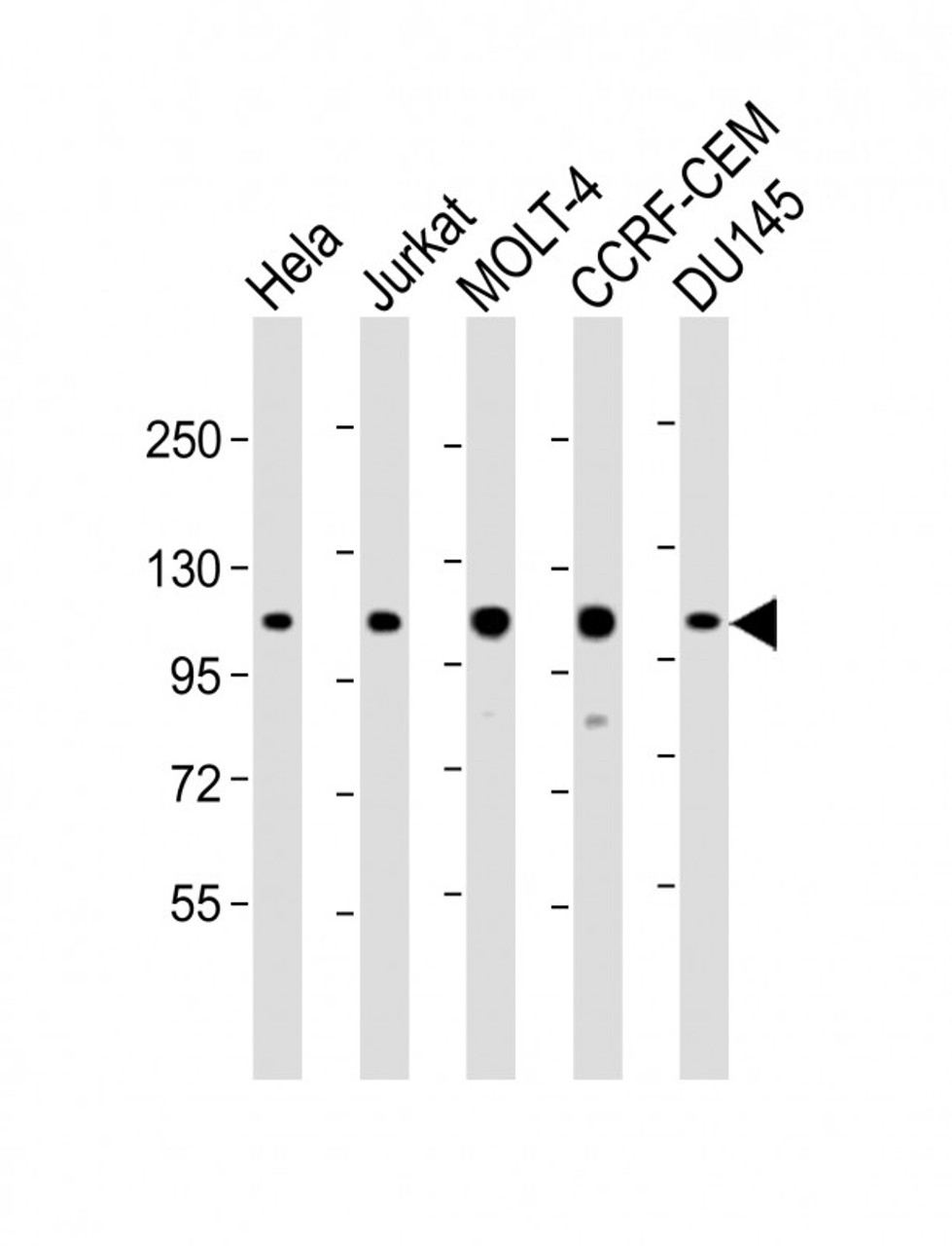 Western Blot at 1:2000 dilution Lane 1: Hela whole cell lysate Lane 2: Jurkat whole cell lysate Lane 3: MOLT-4 whole cell lysate Lane 4: CCRF-CEM whole cell lysate Lane 5: DU145 whole cell lysate Lysates/proteins at 20 ug per lane.