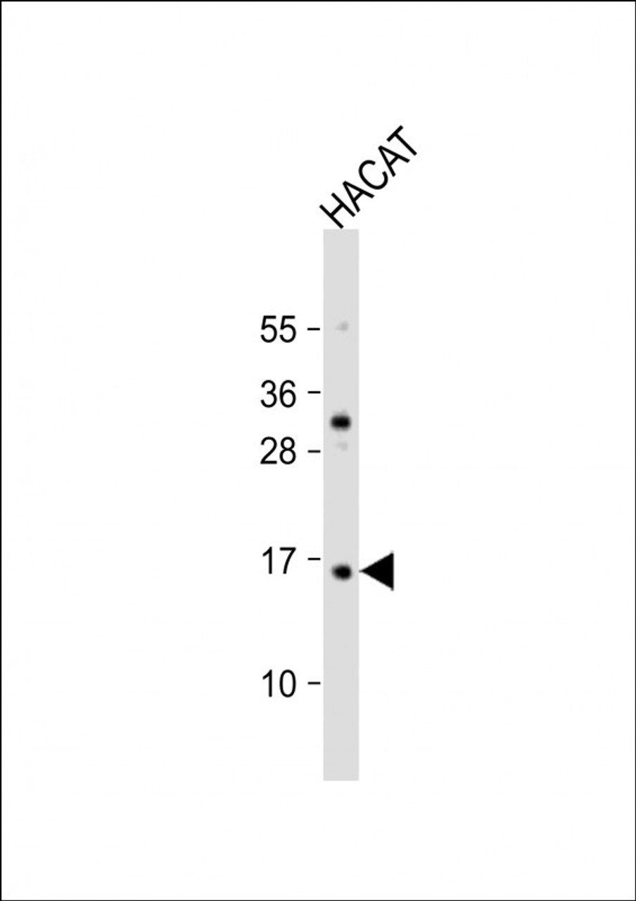 Western Blot at 1:2000 dilution + HACAT whole cell lysate Lysates/proteins at 20 ug per lane.