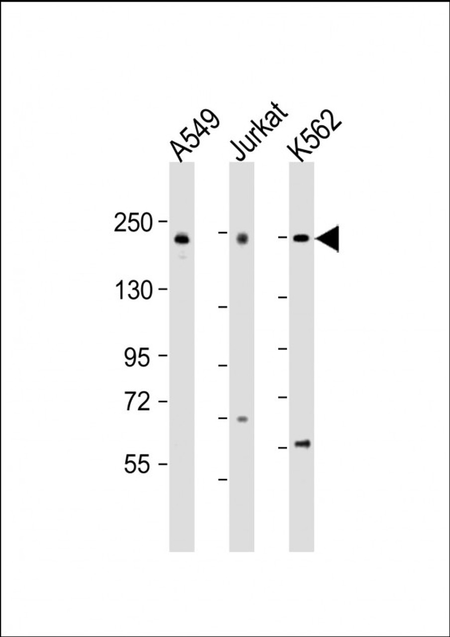 Western Blot at 1:2000 dilution Lane 1: A549 whole cell lysate Lane 2: Jurkat whole cell lysate Lane 3: K562 whole cell lysate Lysates/proteins at 20 ug per lane.