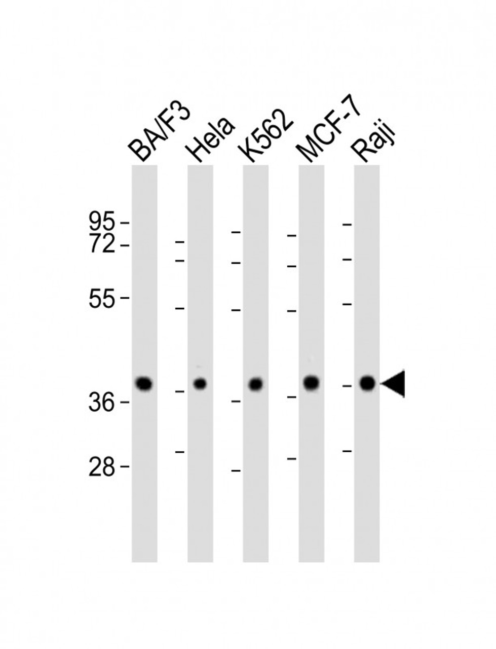 Western Blot at 1:2000 dilution Lane 1: BA/F3 whole cell lysate Lane 2: Hela whole cell lysate Lane 3: K562 whole cell lysate Lane 4: MCF-7 whole cell lysate Lane 5: Raji whole cell lysate Lysates/proteins at 20 ug per lane.