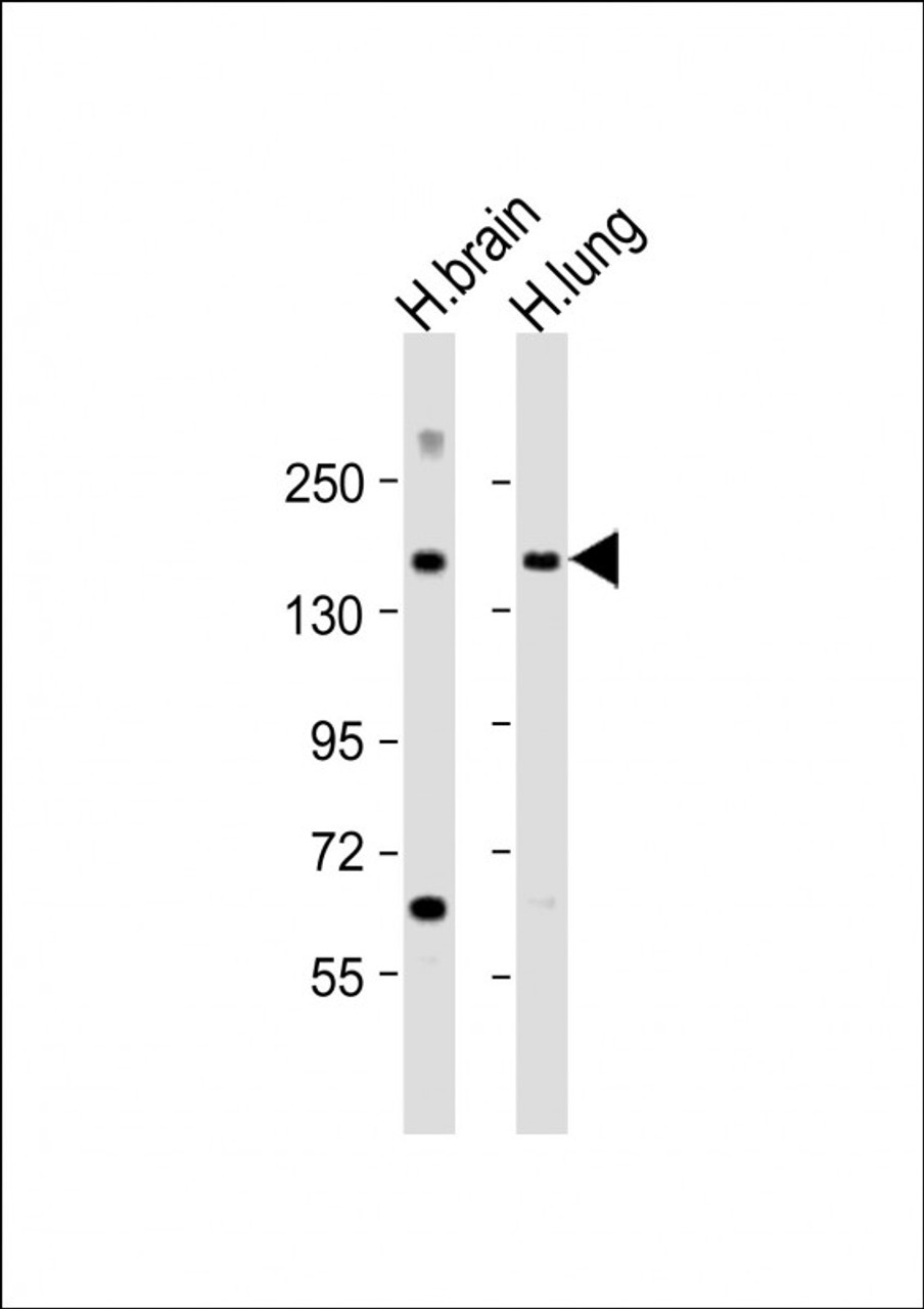 Western Blot at 1:2000 dilution Lane 1: human brain lysate Lane 2: human lung lysate Lysates/proteins at 20 ug per lane.