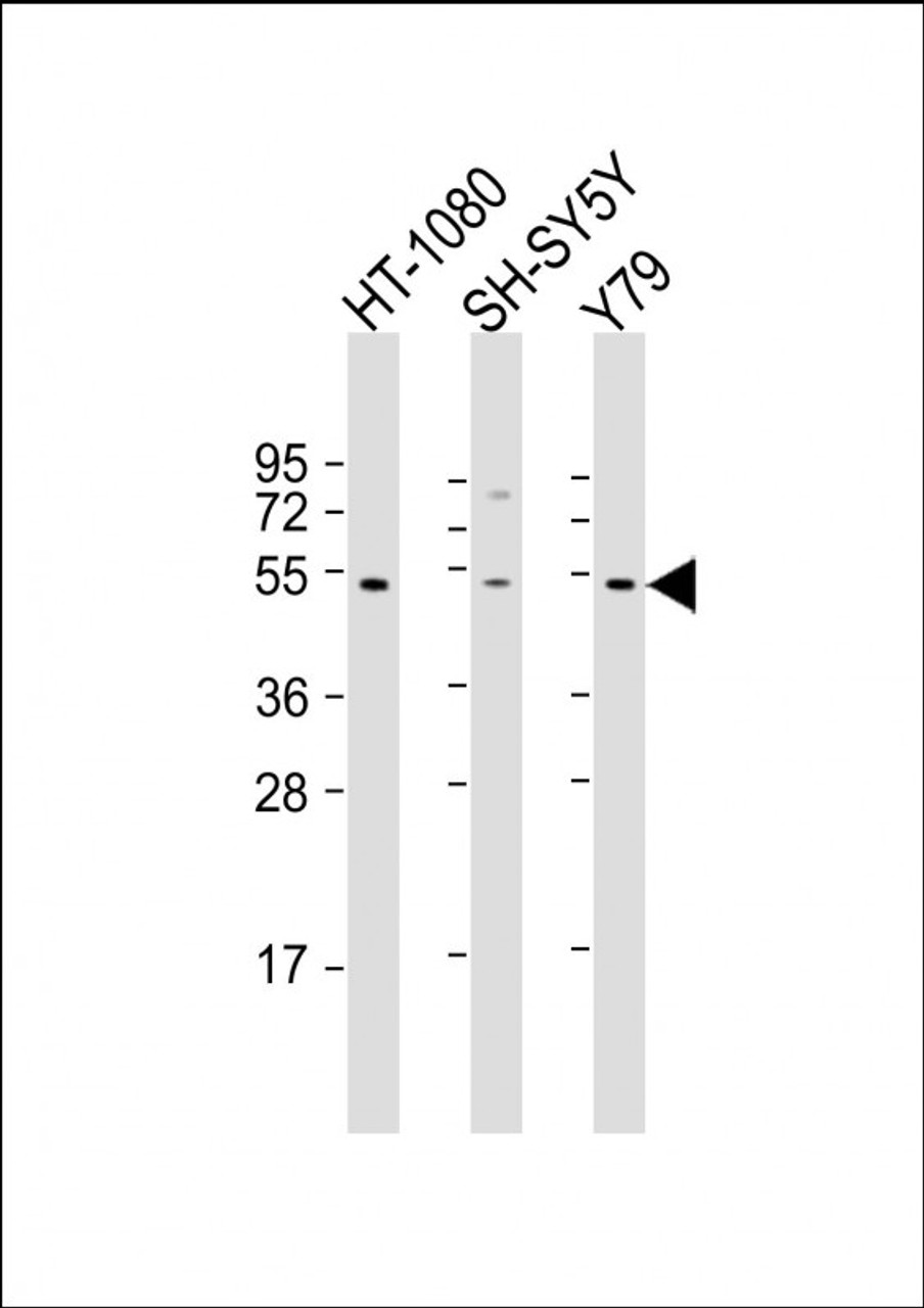 Western Blot at 1:2000 dilution Lane 1: HT-1080 whole cell lysate Lane 2: SH-SY5Y whole cell lysate Lane 3: Y79 whole cell lysate Lysates/proteins at 20 ug per lane.