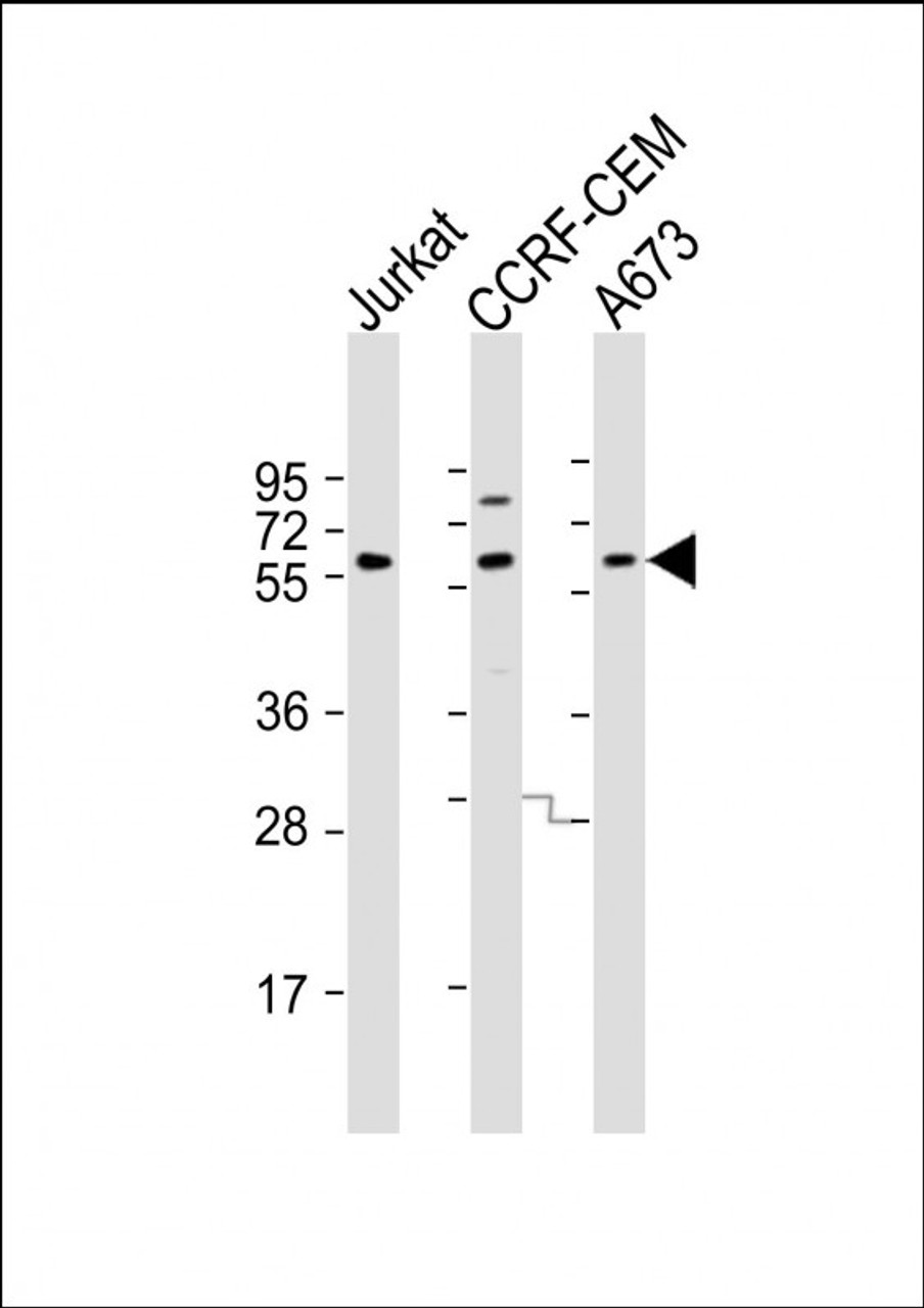 Western Blot at 1:2000 dilution Lane 1: Jurkat whole cell lysate Lane 2: CCRF-CEM whole cell lysate Lane 3: A673 whole cell lysate Lysates/proteins at 20 ug per lane.