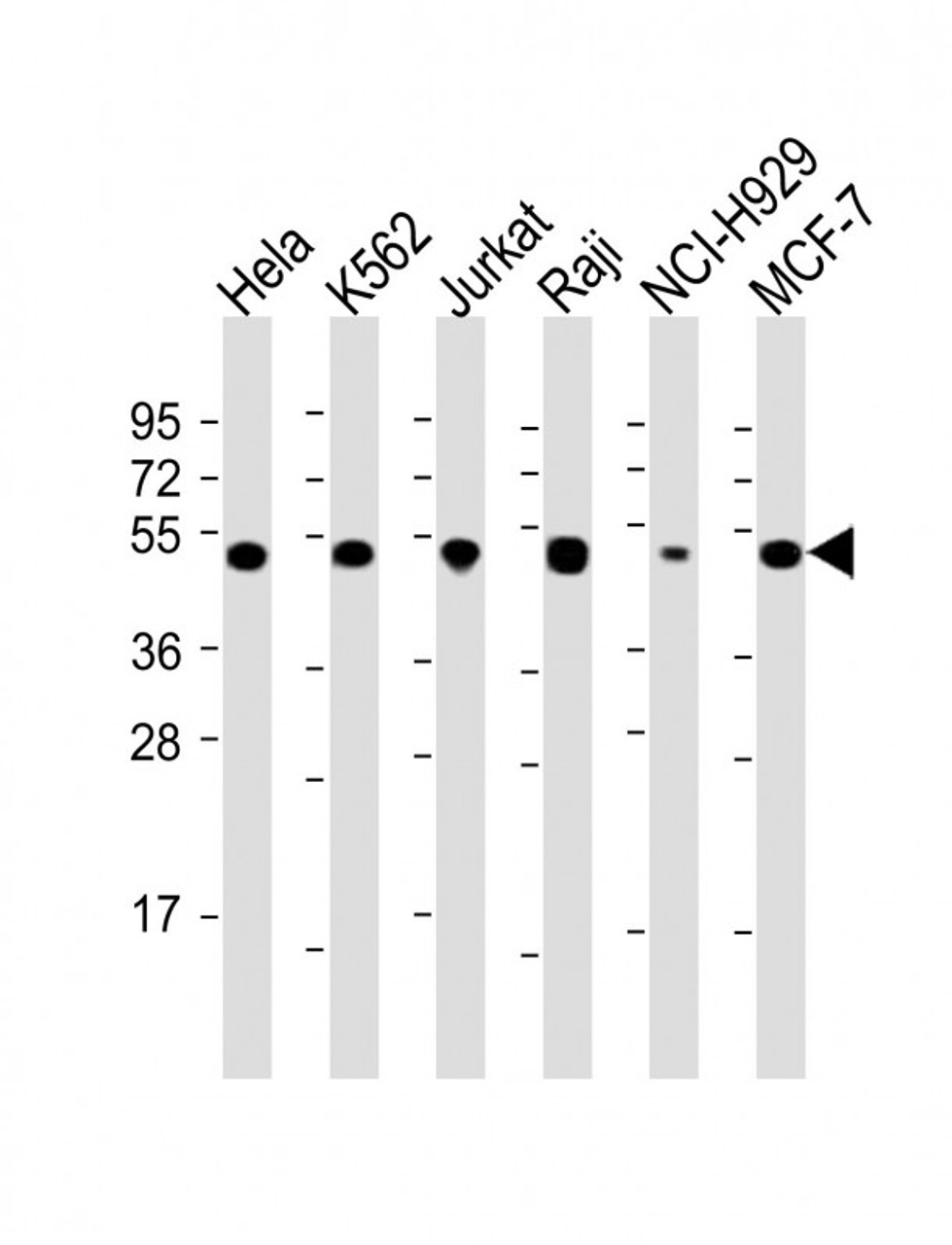Western Blot at 1:2000 dilution Lane 1: Hela whole cell lysate Lane 2: K562 whole cell lysate Lane 3: Jurkat whole cell lysate Lane 4: Raji whole cell lysate Lane 5: NCI-H929 whole cell lysate Lane 6: MCF-7 whole cell lysate Lysates/proteins at 20 ug per lane.