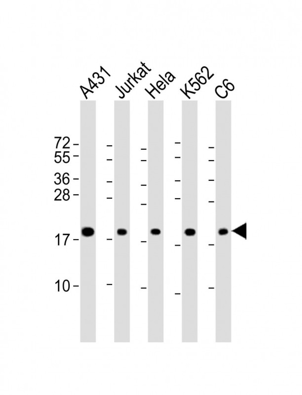 Western Blot at 1:2000 dilution Lane 1: A431 whole cell lysate Lane 2: Jurkat whole cell lysate Lane 3: Hela whole cell lysate Lane 4: K562 whole cell lysate Lane 5: C6 whole cell lysate Lysates/proteins at 20 ug per lane.