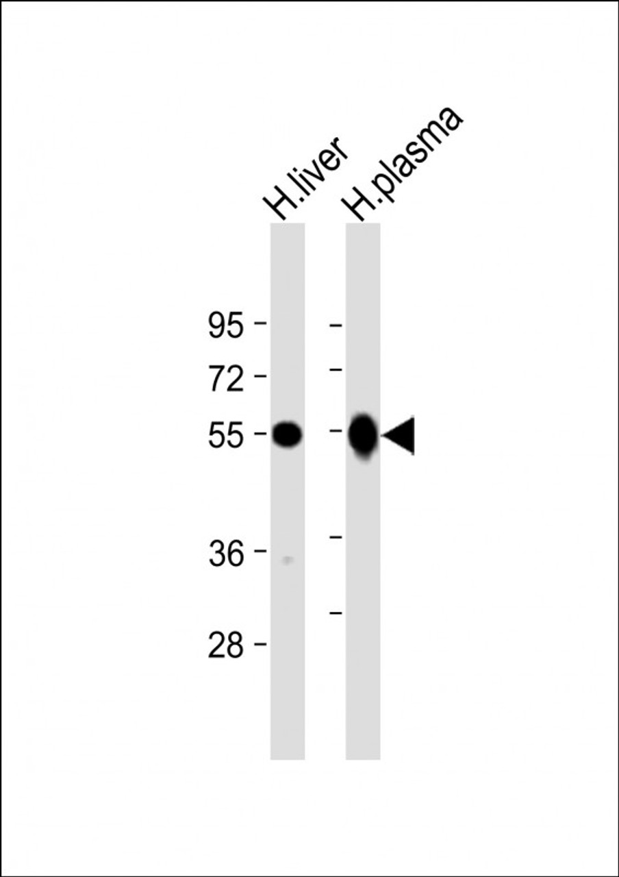 Western Blot at 1:2000 dilution Lane 1: human liver lysate Lane 2: human plasma lysate Lysates/proteins at 20 ug per lane.