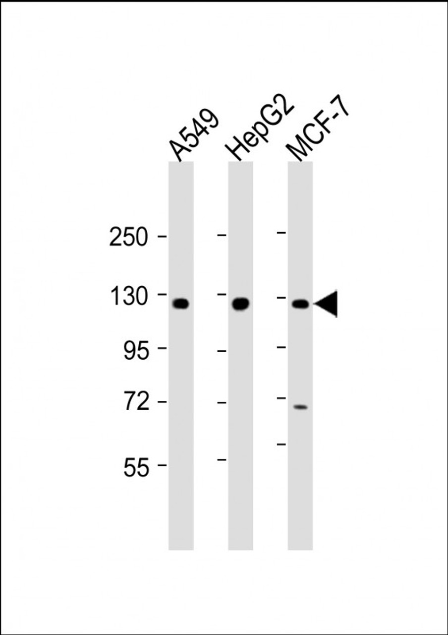 Western Blot at 1:2000 dilution Lane 1: A549 whole cell lysate Lane 2: HepG2 whole cell lysate Lane 3: MCF-7 whole cell lysate Lysates/proteins at 20 ug per lane.