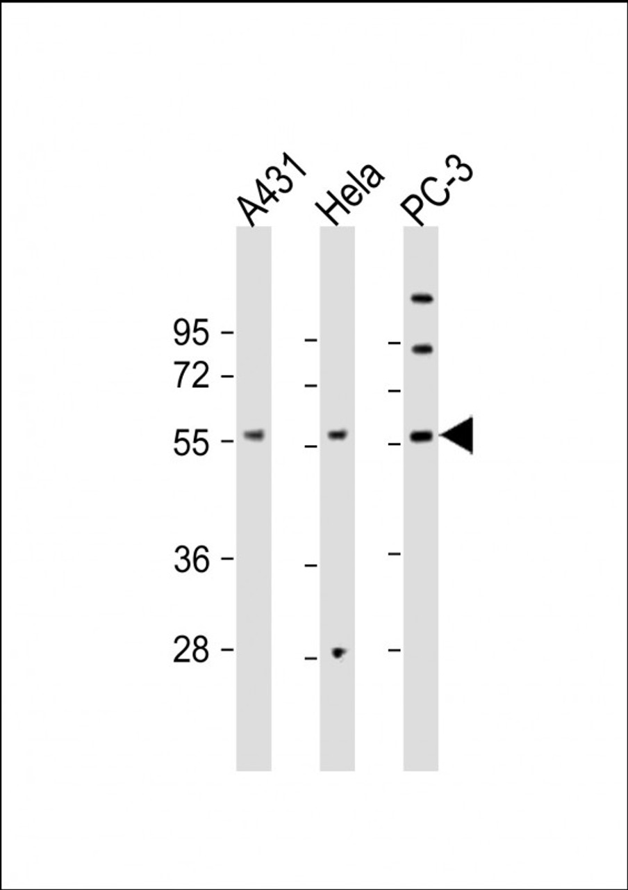 Western Blot at 1:2000 dilution Lane 1: A431 whole cell lysate Lane 2: Hela whole cell lysate Lane 3: PC-3 whole cell lysate Lysates/proteins at 20 ug per lane.