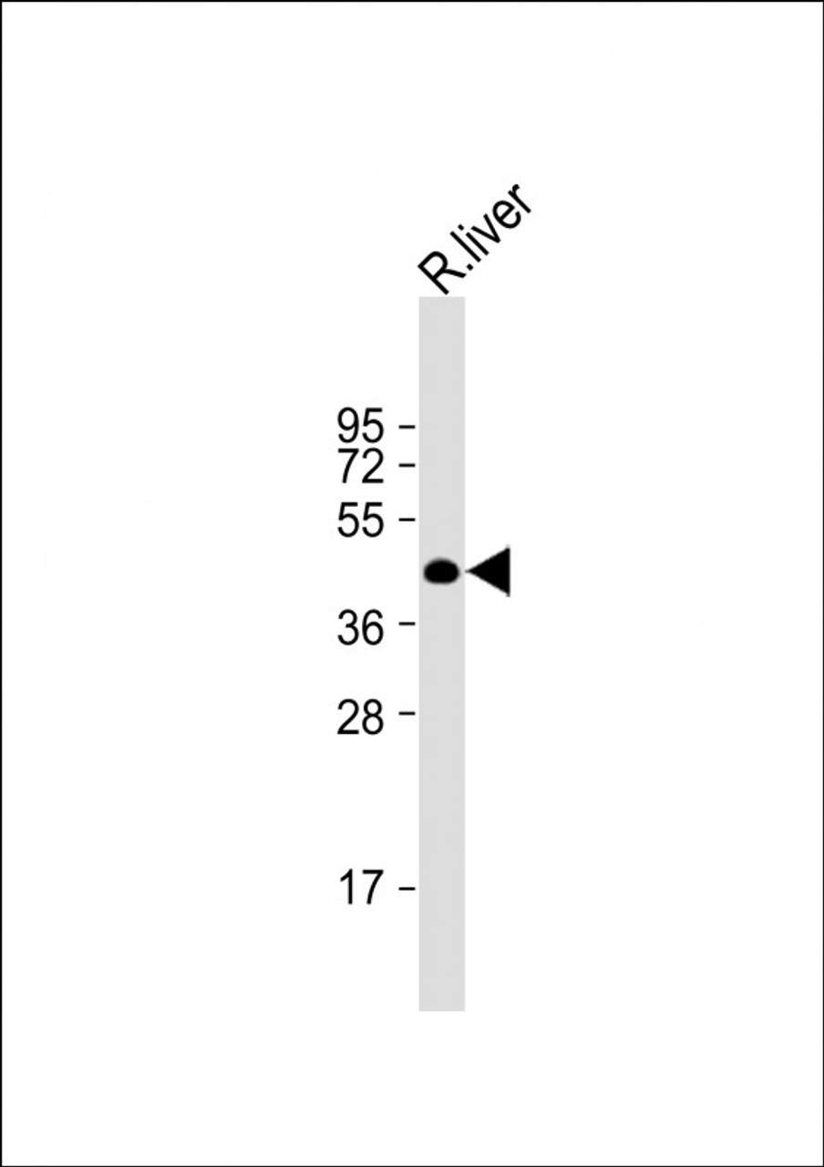 Western Blot at 1:2000 dilution + rat liver lysate Lysates/proteins at 20 ug per lane.