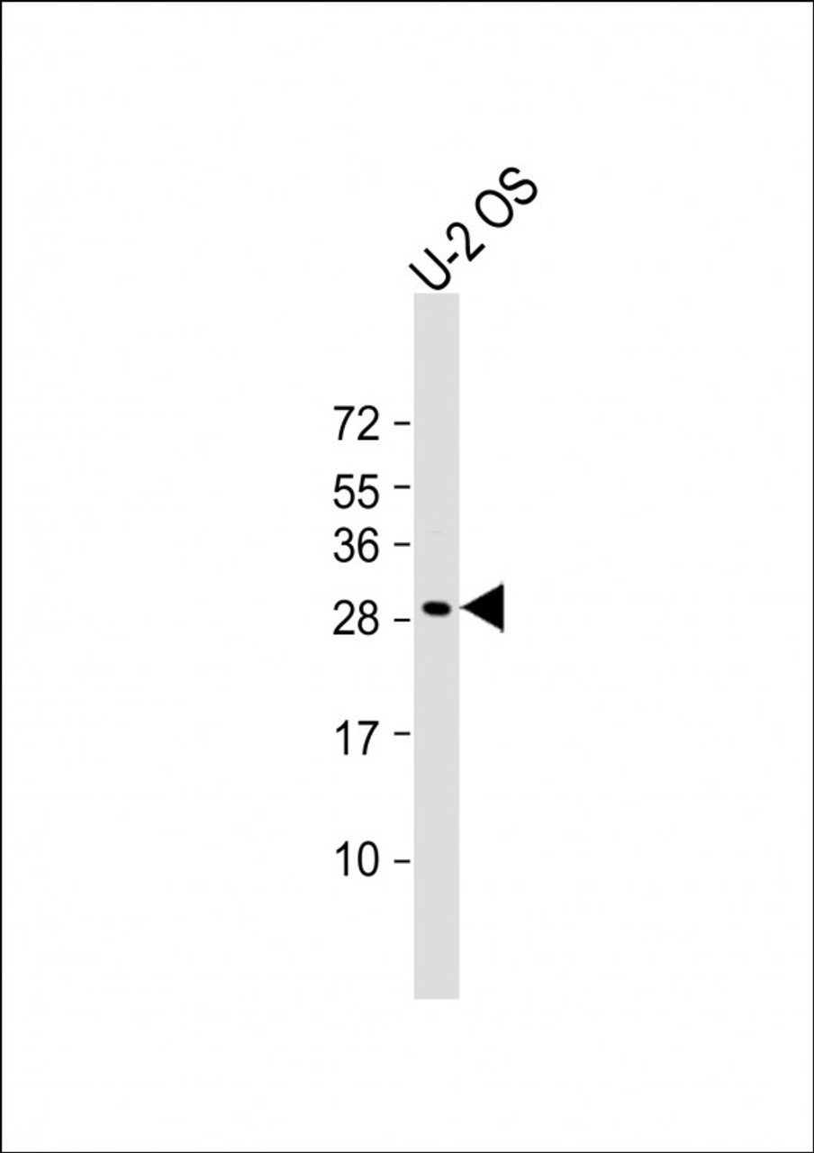 Western Blot at 1:2000 dilution + U-2 OS whole cell lysate Lysates/proteins at 20 ug per lane.
