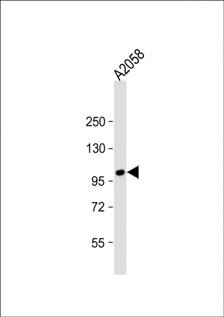 Western Blot at 1:2000 dilution + A2058 whole cell lysate Lysates/proteins at 20 ug per lane.