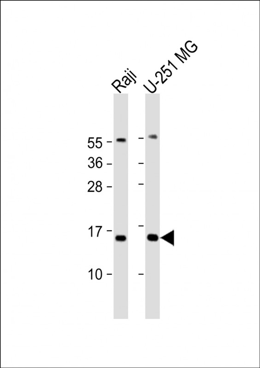 Western Blot at 1:2000 dilution Lane 1: Raji whole cell lysate Lane 2: U-251 MG whole cell lysate Lysates/proteins at 20 ug per lane.