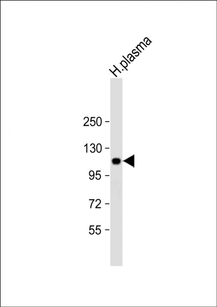 Western Blot at 1:2000 dilution + human plasma lysate Lysates/proteins at 20 ug per lane.