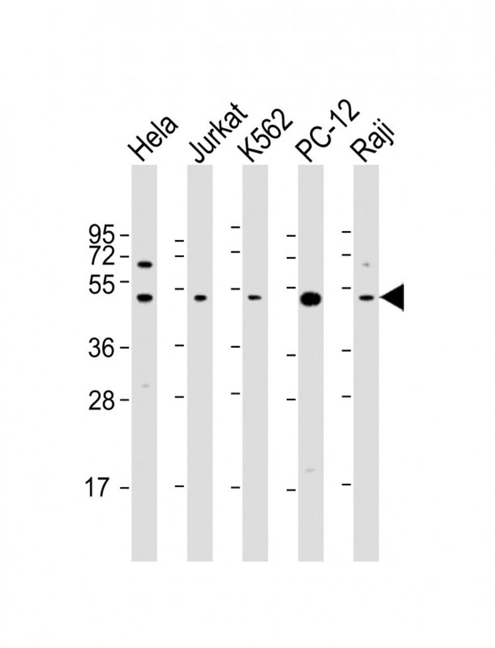 Western Blot at 1:2000 dilution Lane 1: Hela whole cell lysate Lane 2: Jurkat whole cell lysate Lane 3: K562 whole cell lysate Lane 4: PC-12 whole cell lysate Lane 5: Raji whole cell lysate Lysates/proteins at 20 ug per lane.