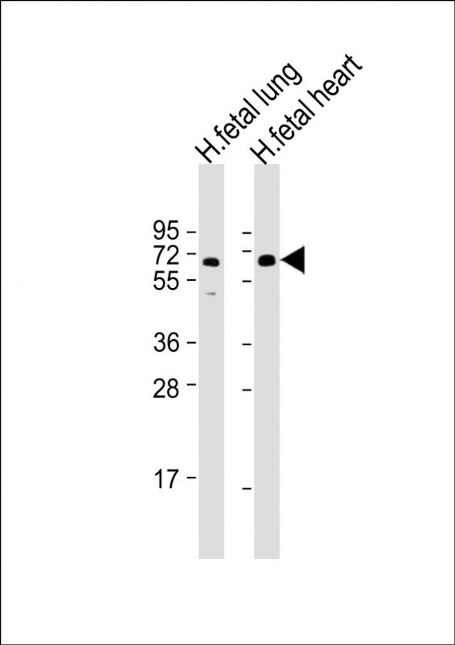 Western Blot at 1:2000 dilution Lane 1: human fetal lung lysate Lane 2: human fetal heart lysate Lysates/proteins at 20 ug per lane.