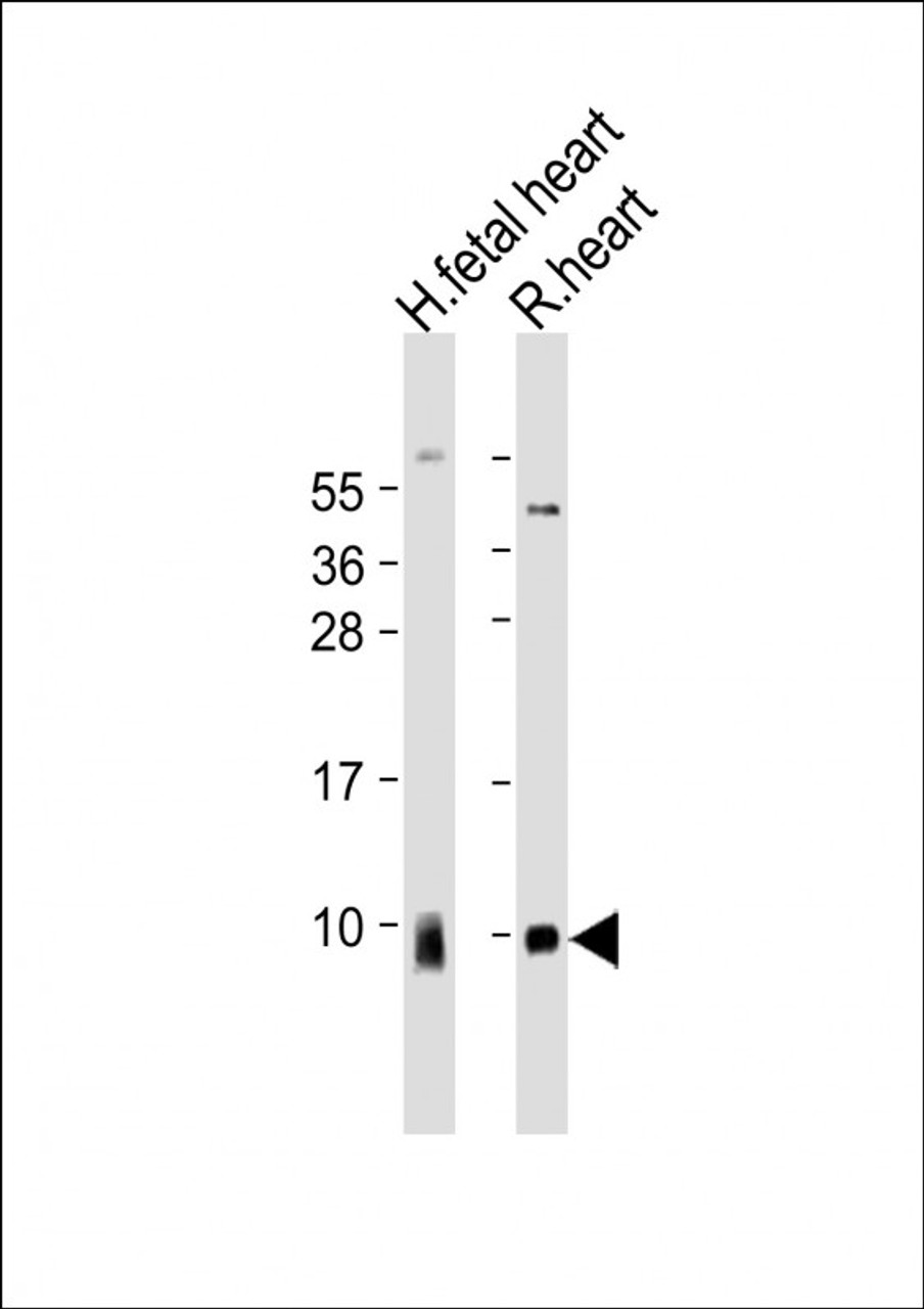 Western Blot at 1:2000 dilution Lane 1: human fetal heart lysate Lane 2: rat heart lysate Lysates/proteins at 20 ug per lane.