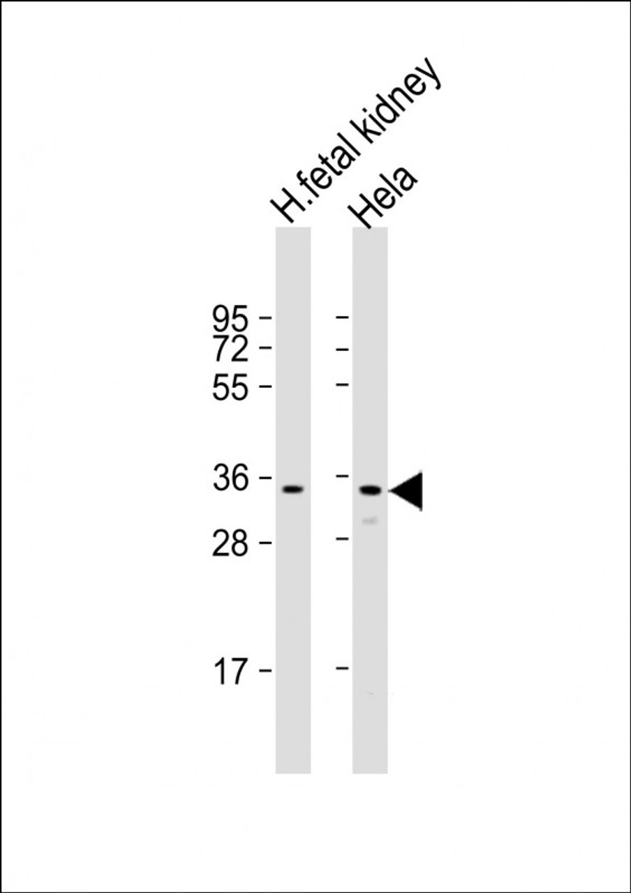 Western Blot at 1:2000 dilution Lane 1: human fetal kidney lysate Lane 2: Hela whole cell lysate Lysates/proteins at 20 ug per lane.