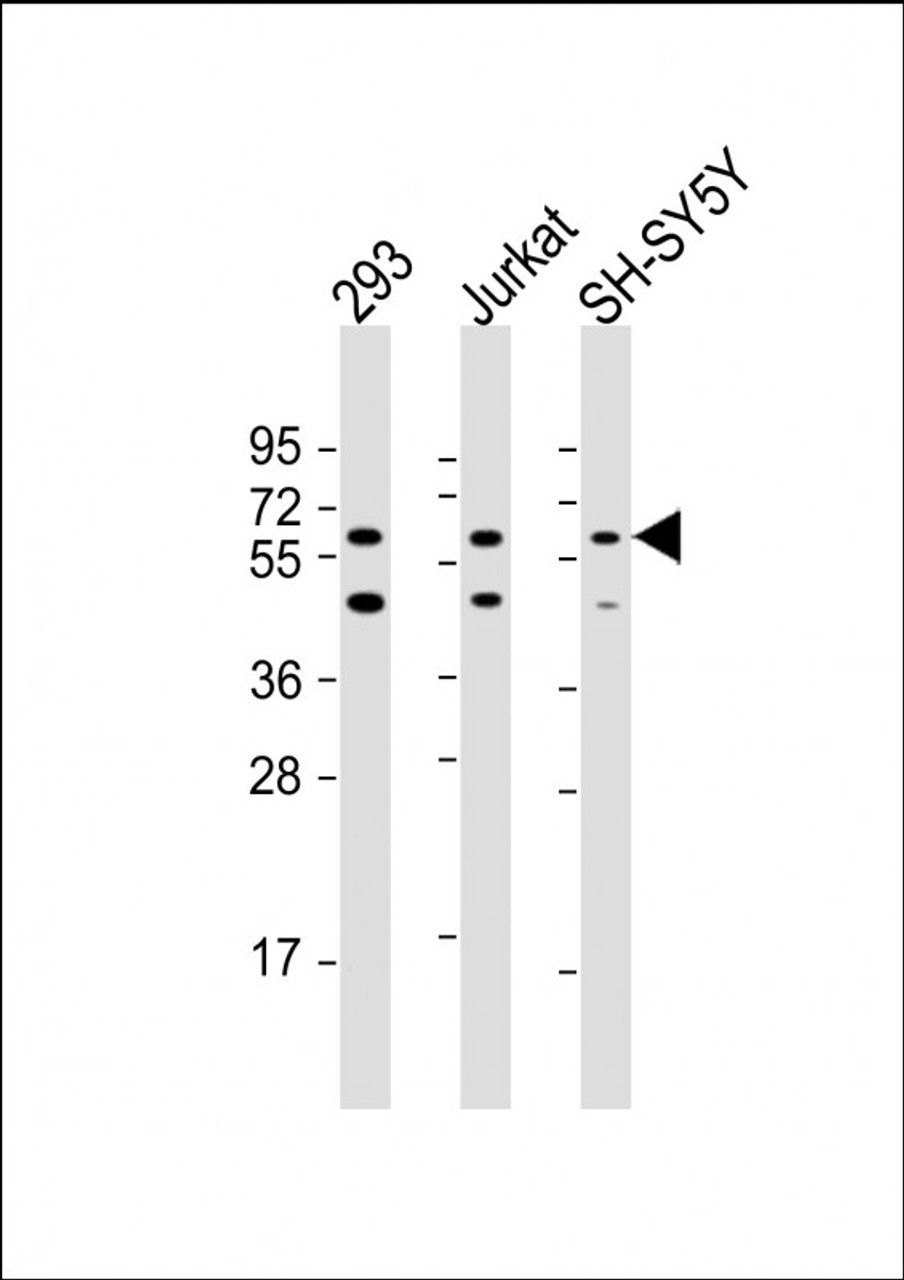Western Blot at 1:2000 dilution Lane 1: 293 whole cell lysate Lane 2: Jurkat whole cell lysate Lane 3: SH-SY5Y whole cell lysate Lysates/proteins at 20 ug per lane.
